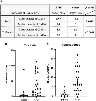 Microbleed clustering in thalamus sign in CADASIL patients with NOTCH3 R75P mutation